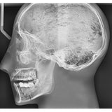 Human Antomy X-Ray Phantom Head with Teeth, Transparent