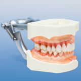 Dental Anatomical Healthy vs Bone Resorption Model