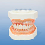 Dental Anatomical Healthy vs Bone Resorption Model