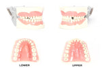 Dental Typodont Model 860 Prep/Cavity Teeth Model Fits Columbia Brand Teeth