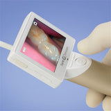 Dental Pro Intraoral Camera SyncVision iO1 Dental Camera