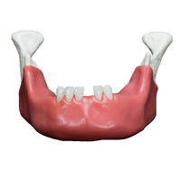 Dental Surgical Training Mandible with Teeth and Soft Tissue