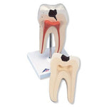 Lower Twin-Root Molar Anatomy Model 2 Parts