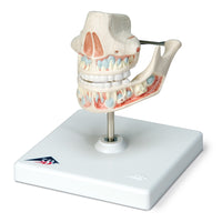 Dental Jaw Model of Milk Dentures Upper and Lower