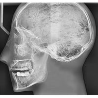 Human Antomy X-Ray Phantom Head with Teeth, Transparent