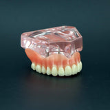 Dental Model Overdenture Superior with 4 Implants Demo Model Pink