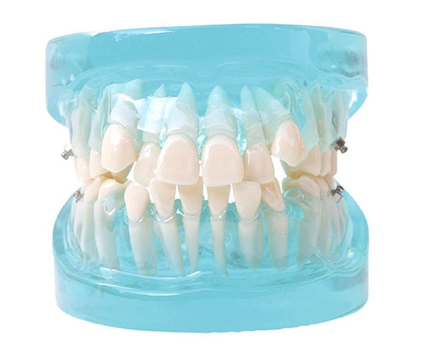 Dental Orthodontic Treatment Standard Study Model Blue