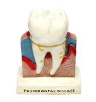 Dental Teeth Oral Anatomical Teaching Standing Decoration Model Figure