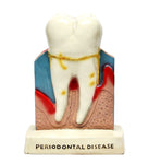 Dental Teeth Oral Anatomical  Decoration Model